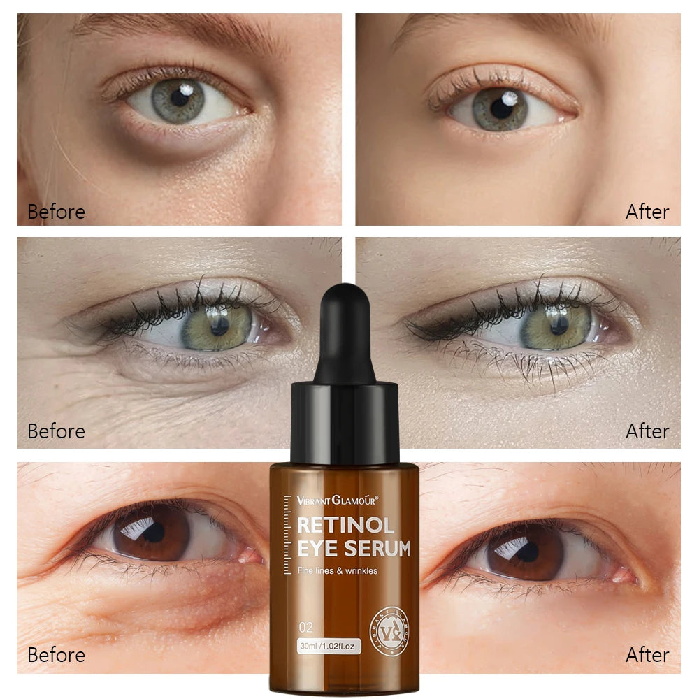 Retinol Eye Serum Repairs and Firms Fine Lines Around the Eyes 30ml